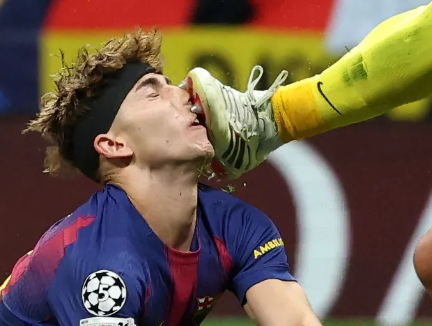 Umukinnyi wa FC Barcelona yakomeretse izuru nyuma yo kugongwa n’umuzamu